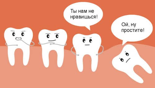 Удаление зуба мудрости